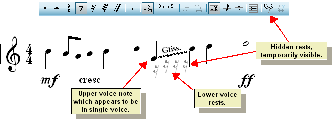 HiddenRestsForGlissando