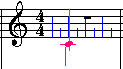 LowerVoiceStemDownSprite