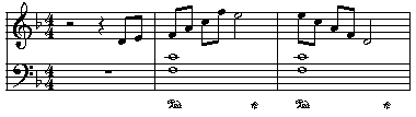 PedalExample2